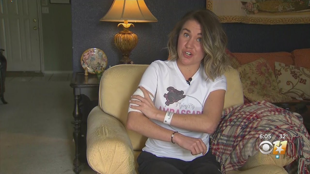 Maratonista profesional es atacada por un pitbull llamado Taco