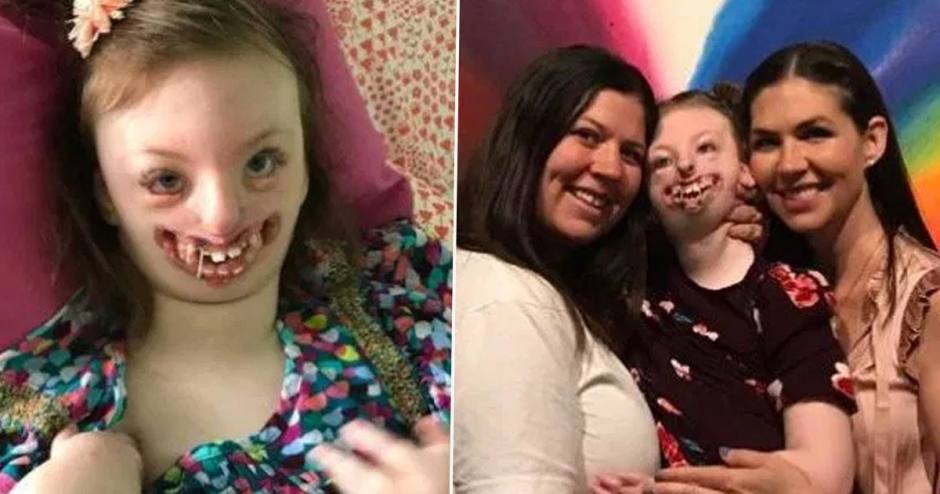 Niña desfigurada, insultada por su aspecto, muere a los 10 años