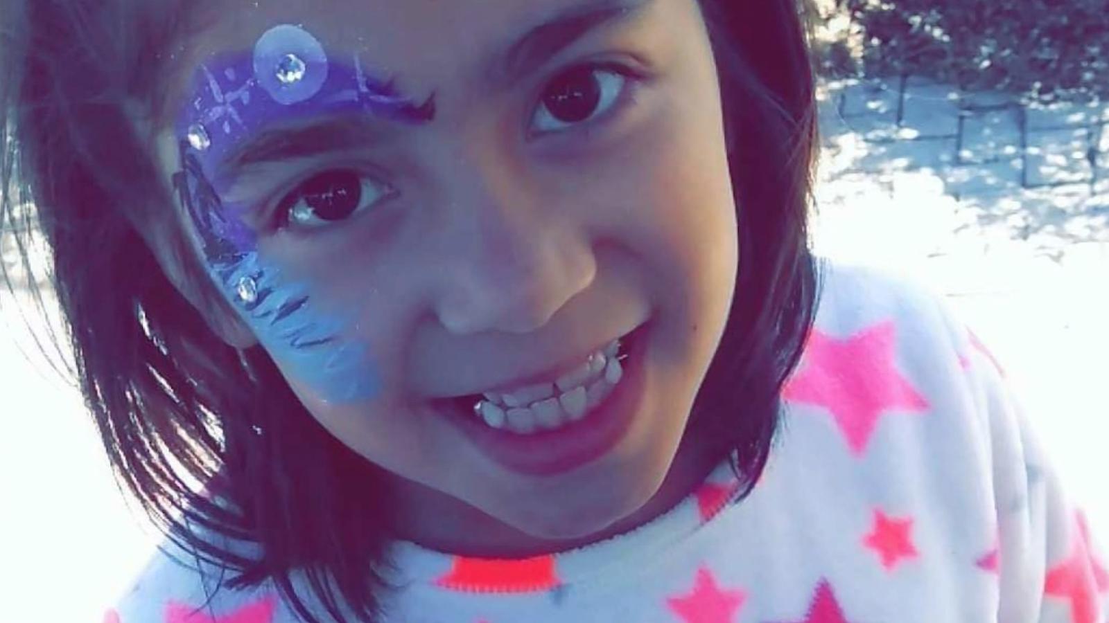 Niña es asesinada por tres pitbulls cuando andaba en su bicicleta