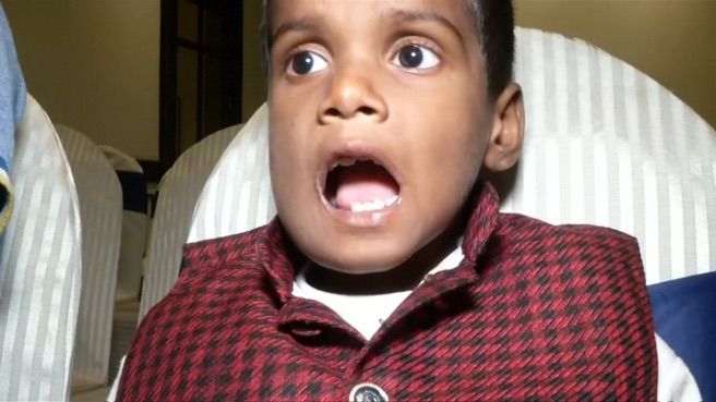 Niño de 7 años tiene 526 dientes, caso único en el mundo