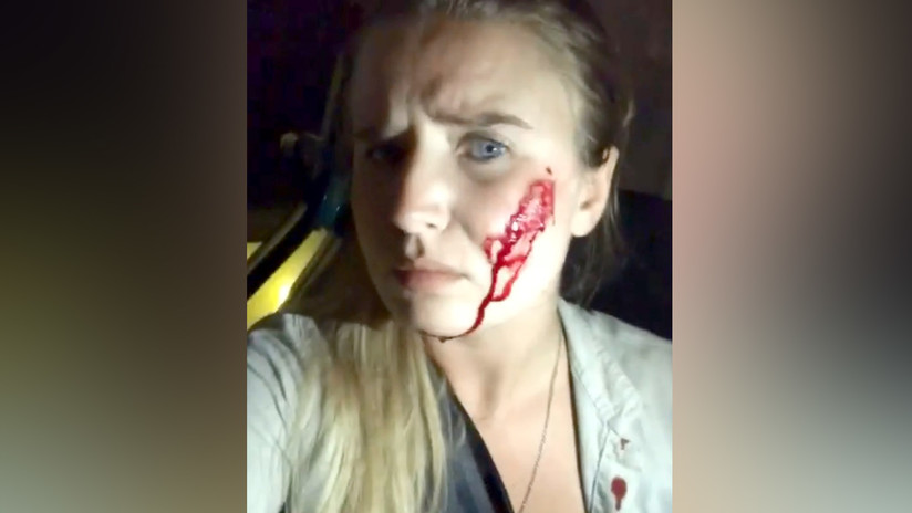 Activista vegana libera 16 conejos y los granjeros disparan contra su auto