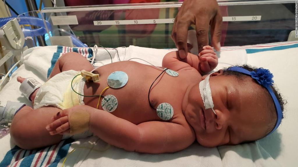 Nació a las 9:11, el 11/9 y pesó 9lbs y 11oz