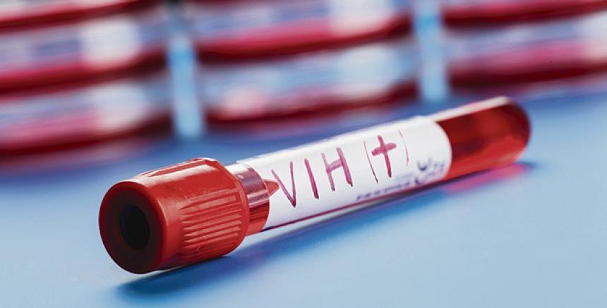 Esfuerzos para combatir el VIH entre los latinos todavía son insuficientes