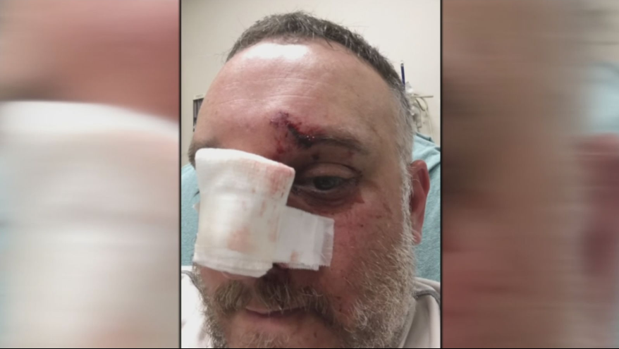 Una roca golpea en la cara a un hombre de Warwick  mientras conduce