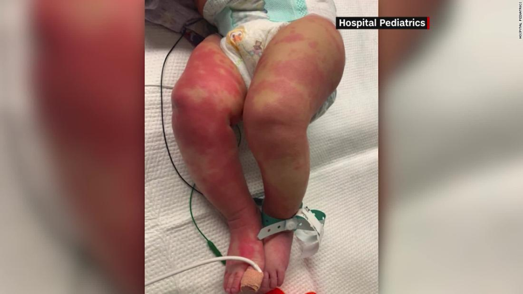 Médicos advierten más casos de síndrome extraño relacionado al coronavirus en niños