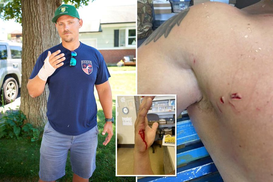 Tiburón mordió a salvavidas y huyó tras manotazos en Nueva York