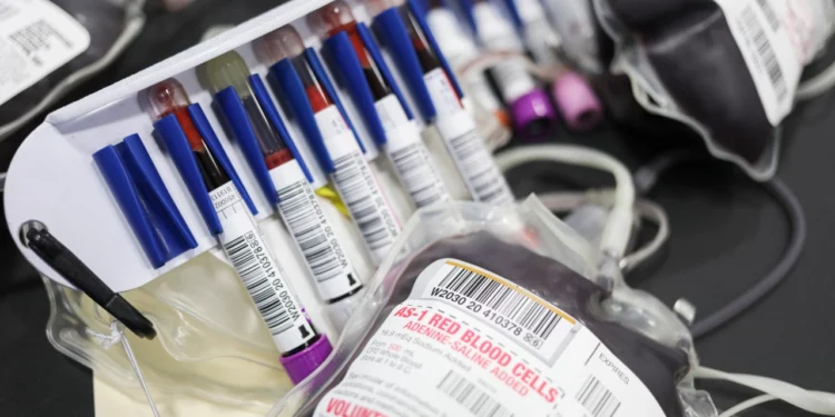 La FDA vuelve a suavizar las normas para los homosexuales que deseen donar sangre