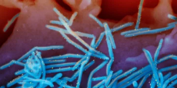 Los asesores de la FDA respaldan la vacuna contra el VRS para embarazadas que protege a sus recién nacidos